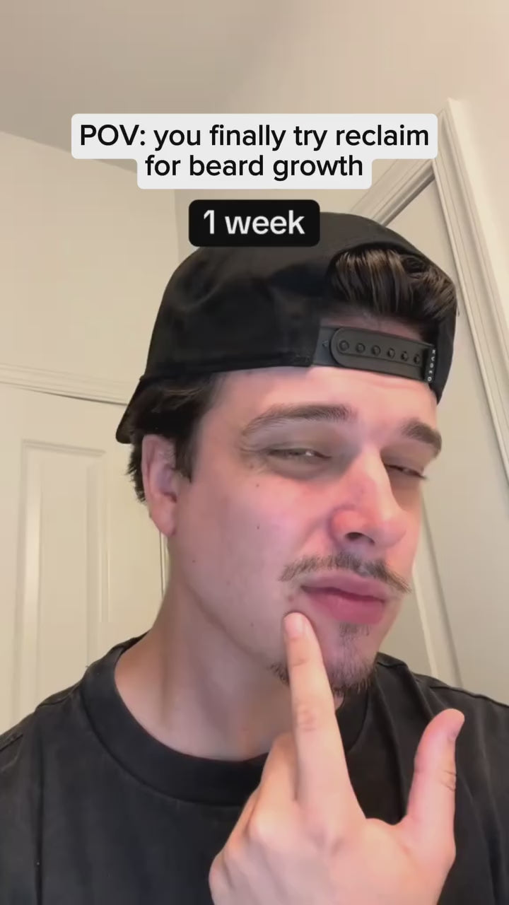 Load video: <p>Voici un avant/après qui montre le résultat de notre sérum Zeliore pour faire pousser les barbes. Profitez de la garantie satisfait ou remboursé dès maintenant<br/></p>